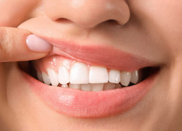 smile-pic